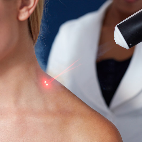 cold laser treatment